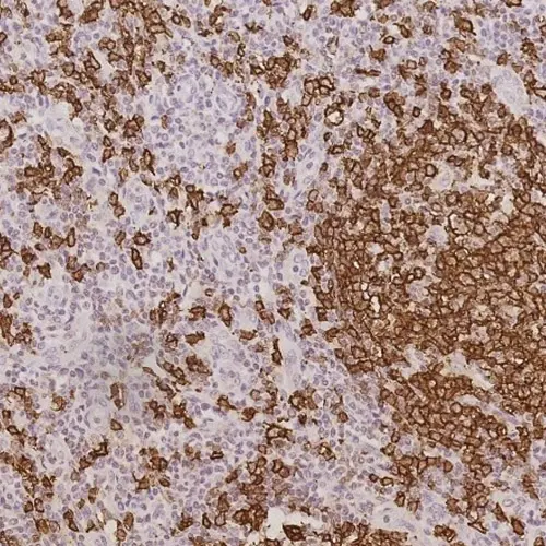 30ml CD20 (L26) Bond RTU Primary product photo