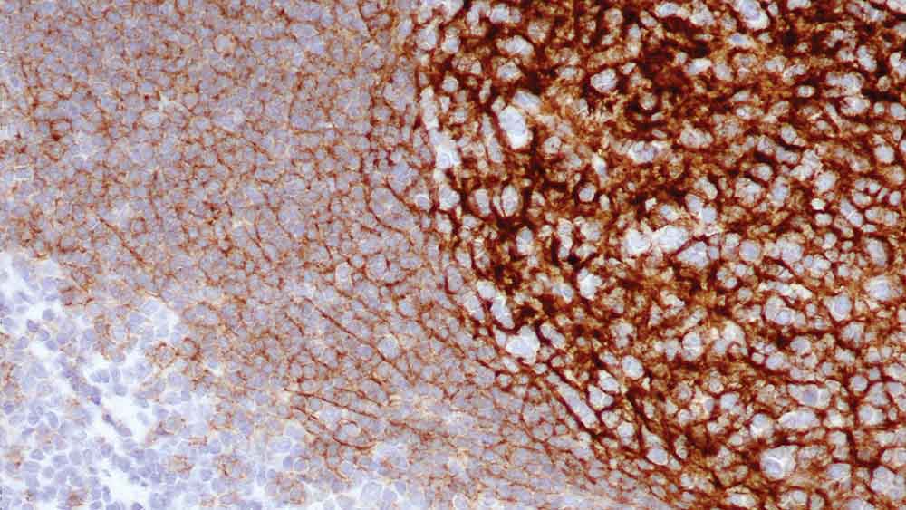 1ml NCL-L-CD21-2G9 product photo