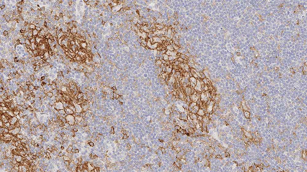1ml NCL-L-CD33 product photo