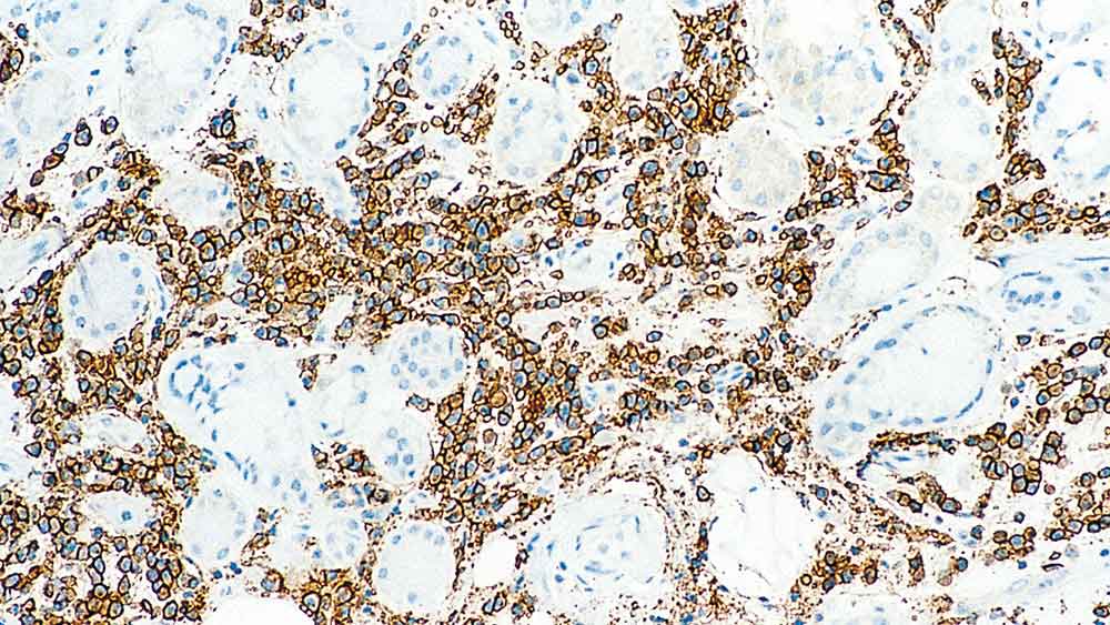 1ml NCL-L-CD38-290 product photo