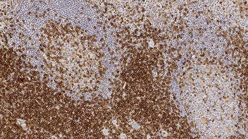 CD4 product photo Front View S