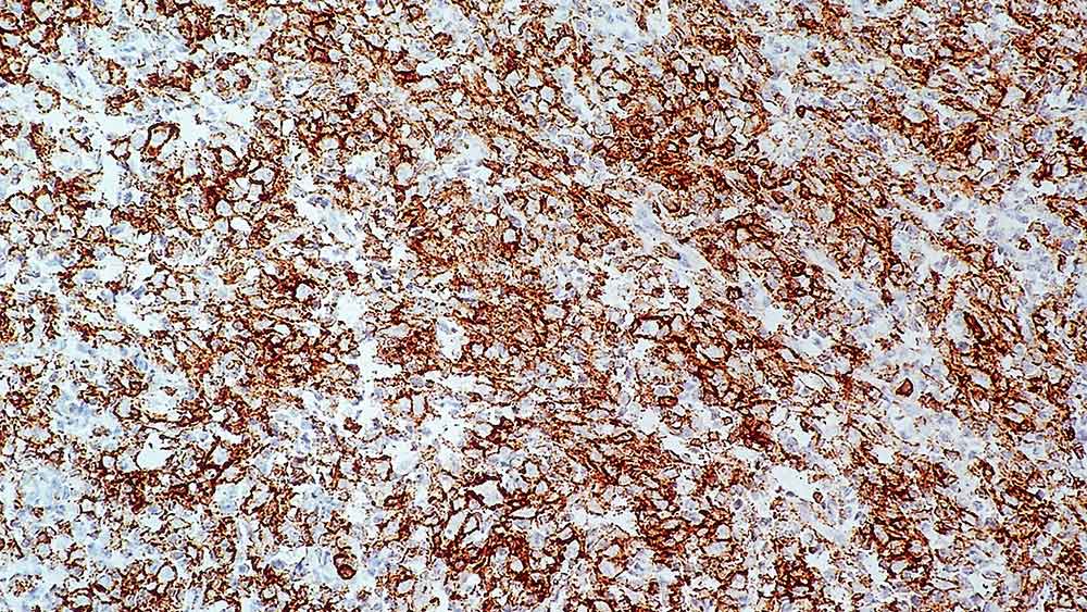 1ml NCL-L-MT1 product photo