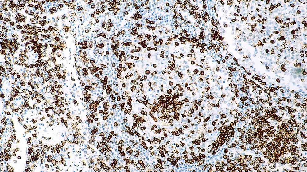 7ml CD45RO Bond RTU Primary product photo