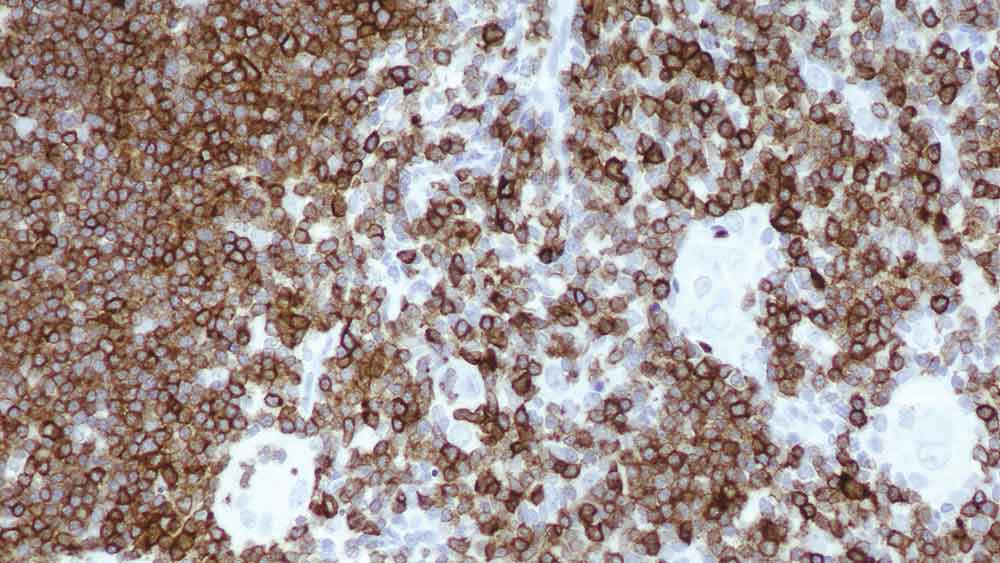 1ml NCL-L-CD7-580 product photo