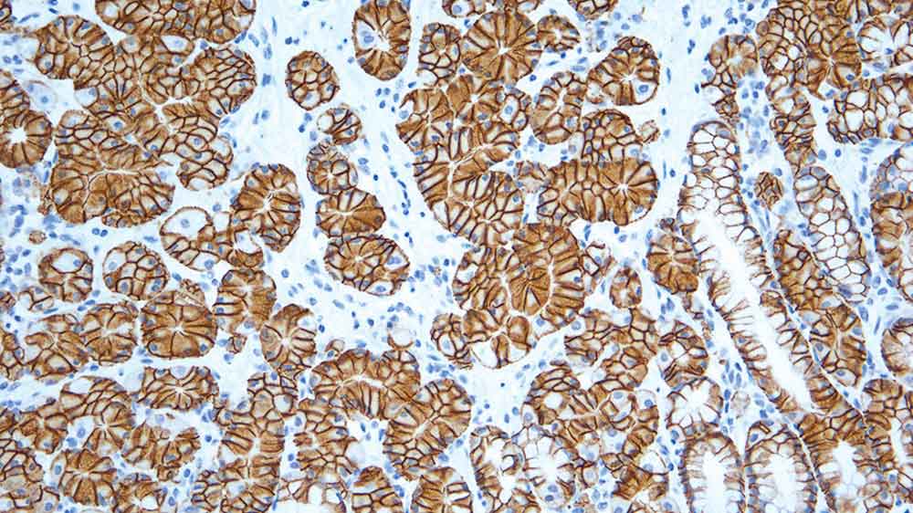1ml NCL-L-CAIX product photo