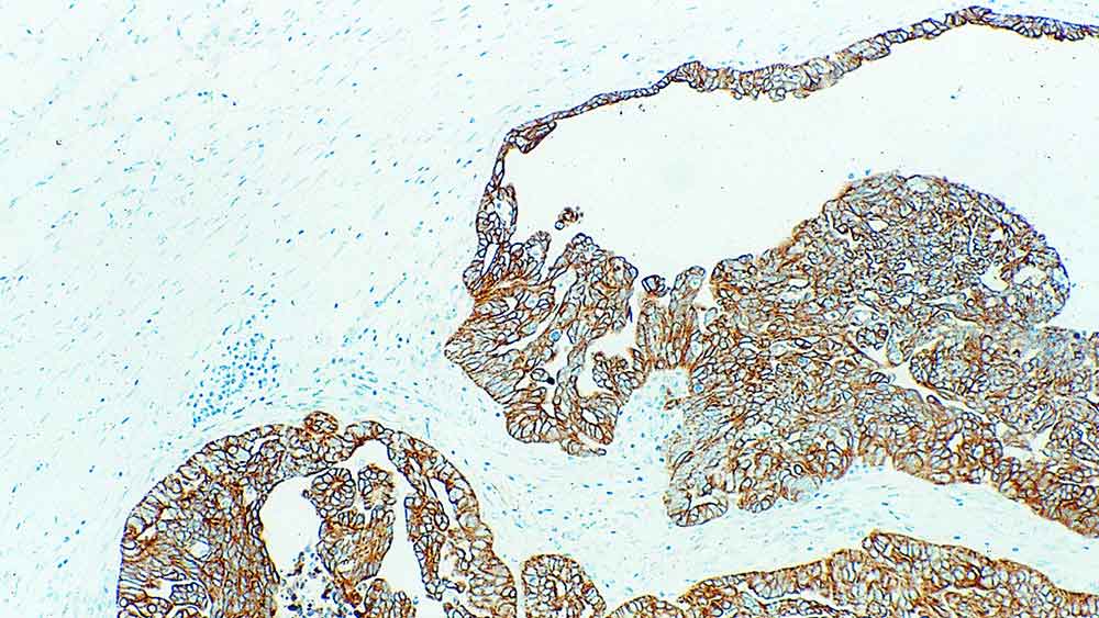 Cytokeratin 18 product photo