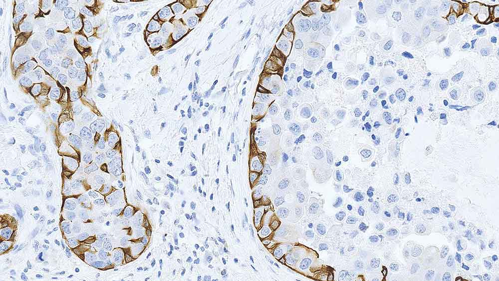 1ml NCL-L-CK5 product photo