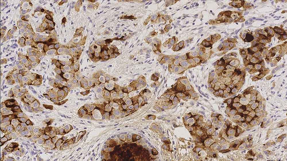 1ml NCL-L-GCDFP15 product photo