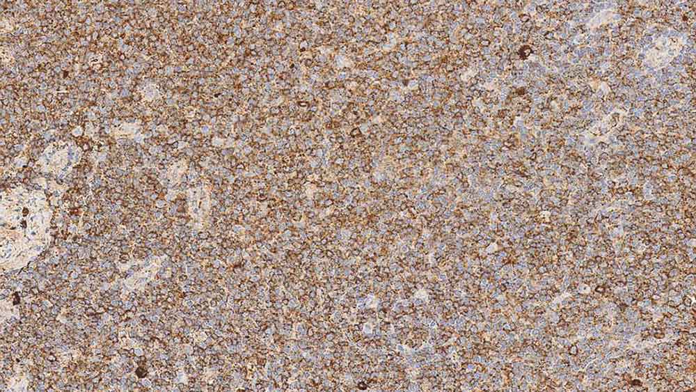 1ml NCL-L-LAM-578 product photo
