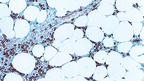7ml Myeloperoxidase BondRTU Pr product photo