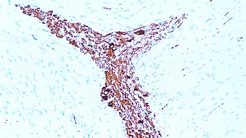 Nitric Oxide Synthase 1 product photo