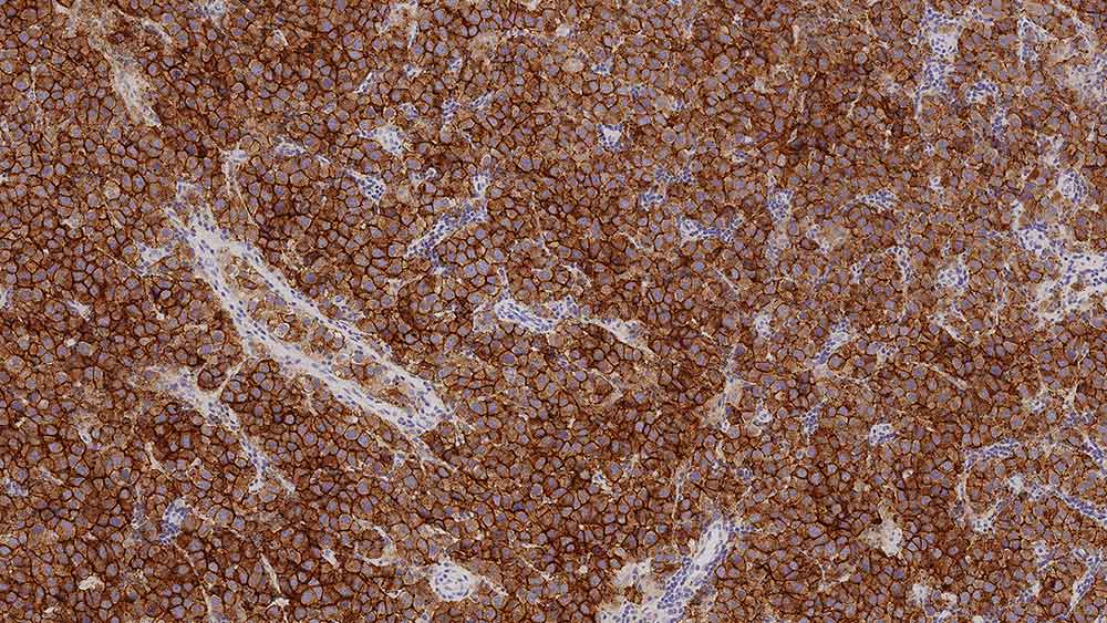 1ml NCL-L-PLAP-8A9 product photo