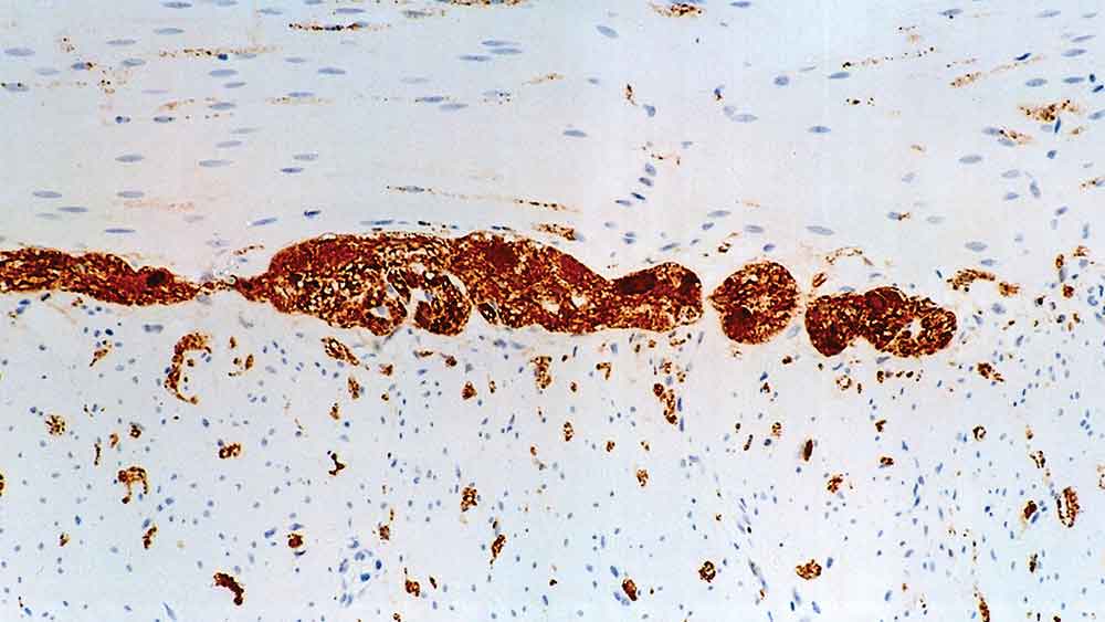 7ml PGP 9.5 Bond RTU Primary product photo