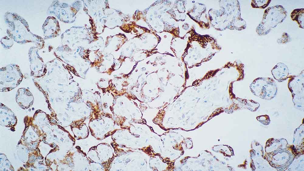 Vascular Endothelial Growth Factor Receptor-3 product photo