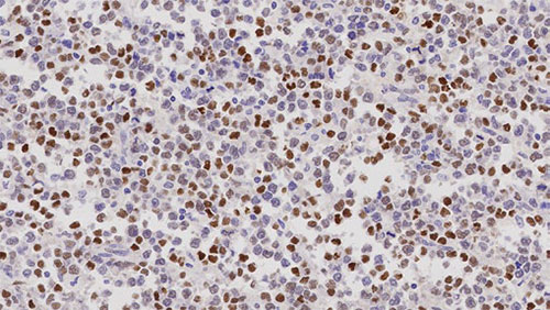 7ml Cyclin D1 (EP12) Bond RTU Primary product photo