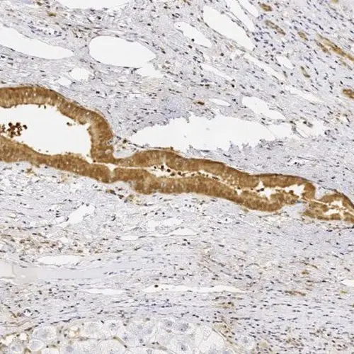 Glutathione S-Transferase (GST) Antibody product photo
