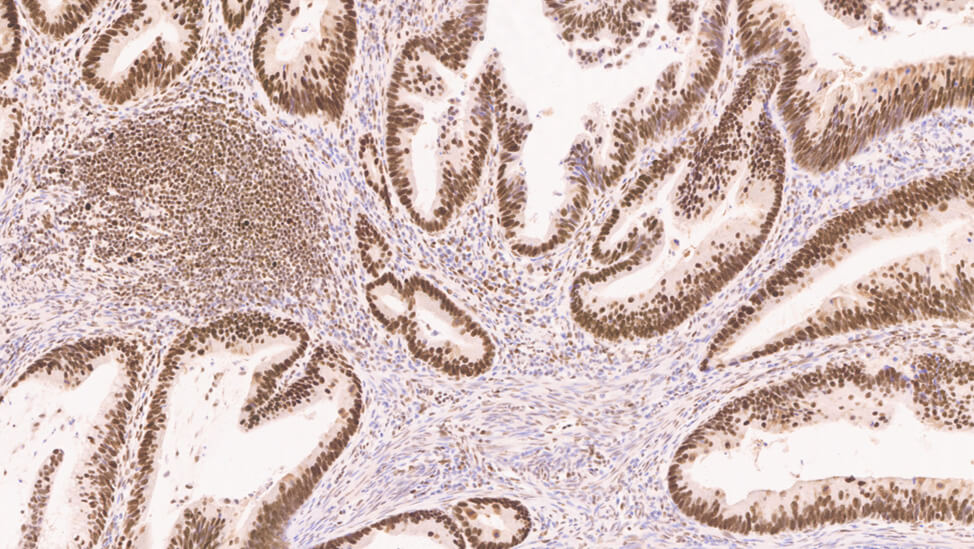 1ml NCL-L-MLH1 product photo