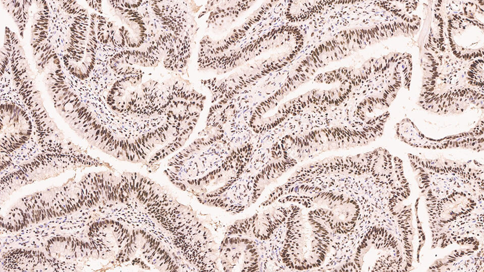 1ml NCL-L-MSH2-612 product photo