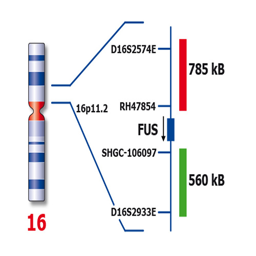 FUS (16p11) Break – XL for BOND product photo Back View S