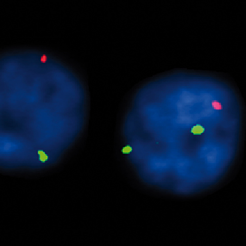 IVD 11q23/DLEU1 product photo Front View S