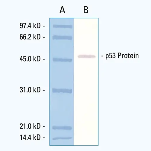 p53 Protein (CM5) product photo