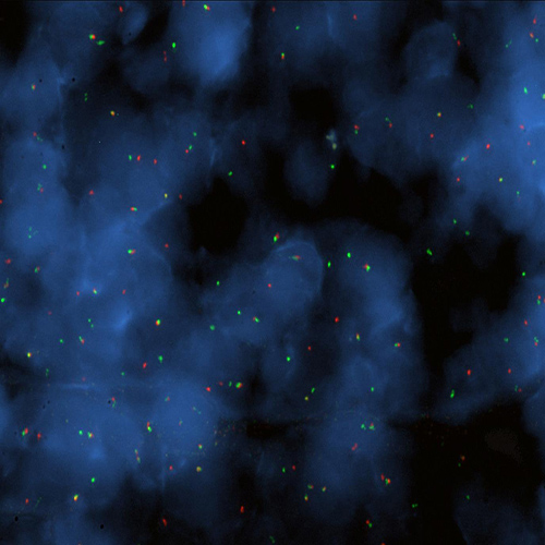 IVD BCL6 Break (tissue) Foto do produto Front View S