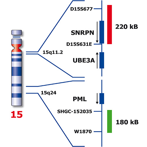 IVD SNRPN/PML Foto do produto Back View S