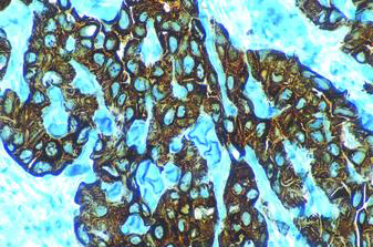 ANTICORPO ANTI-CITOKERATINA HMW BOND RTU Foto do produto