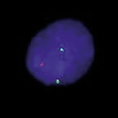 IVD ETV6 Break Foto do produto Front View S