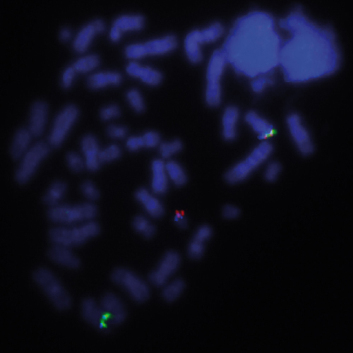 IVD MYC (8q24) Break Foto do produto Front View S