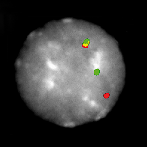 IVD MECOM Break Foto do produto Front View S
