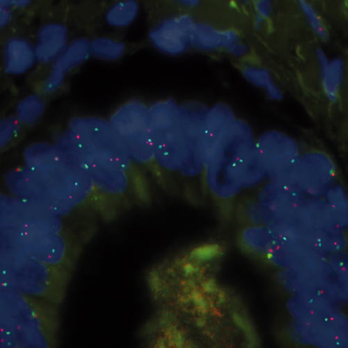 IVD EGFR/SE 7 Foto do produto Front View S