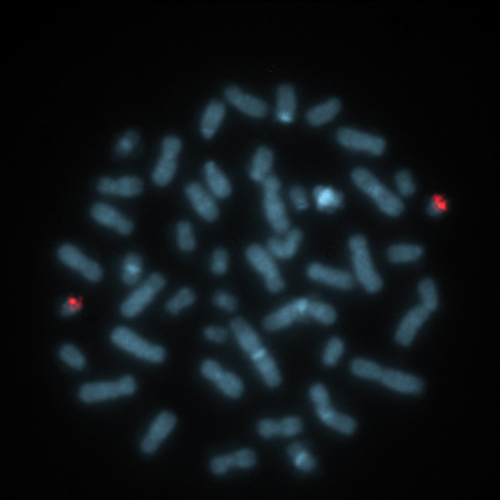 PN 21 (21q22) Foto do produto