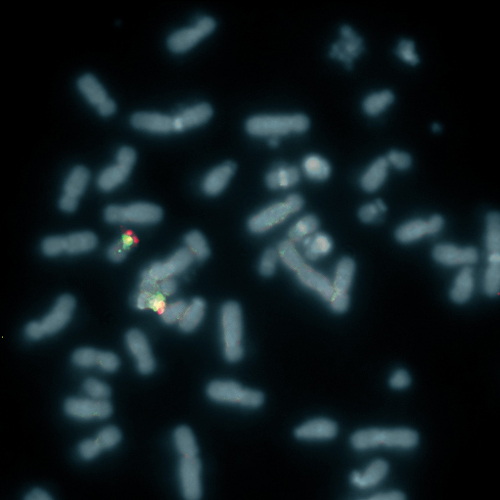 IVD PAFAH1B1/17p11 Foto do produto Front View S