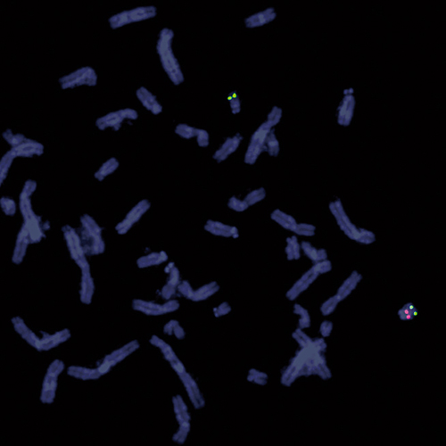 IVD TBX1/SHANK3 Foto do produto Front View S