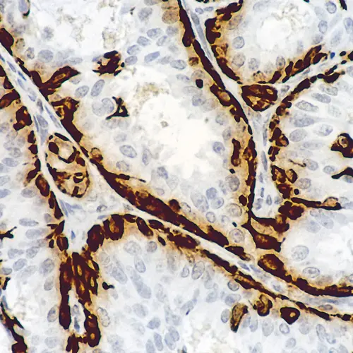 Sistemas de detecção de polímero Novolink Foto do produto