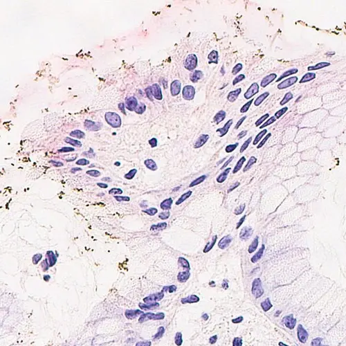 Helicobacter pylori Foto do produto Front View S