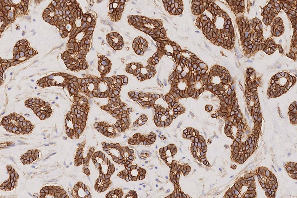 P120 Catenin Foto do produto Front View S