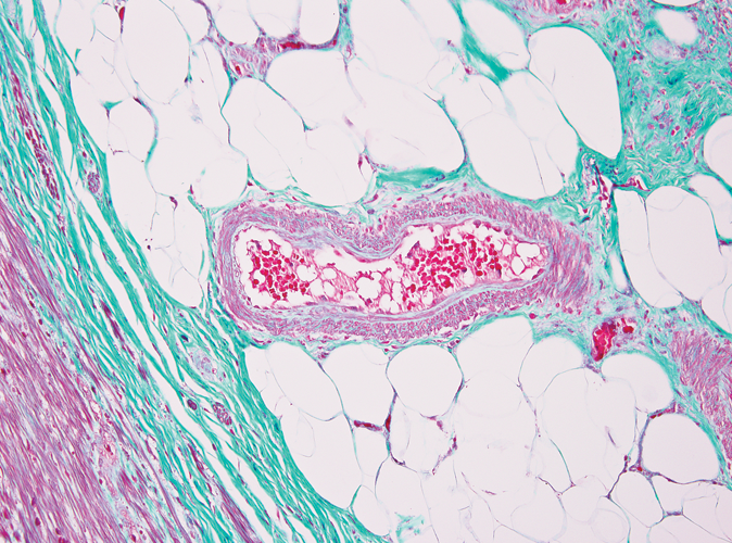 Kit de coloração especial tricromo de Gomori (colágeno verde) Foto do produto Front View S