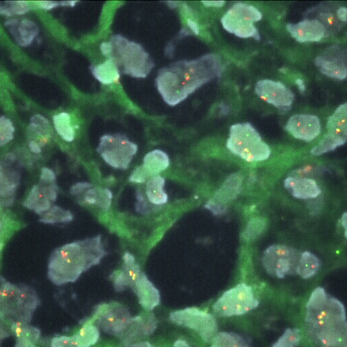 COL1A1/PDGFB t(17;22) DC, S-Fusion product photo