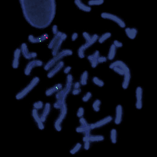 IVD 7q- product photo Front View S