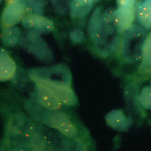 IVD FUS Break product photo Front View S