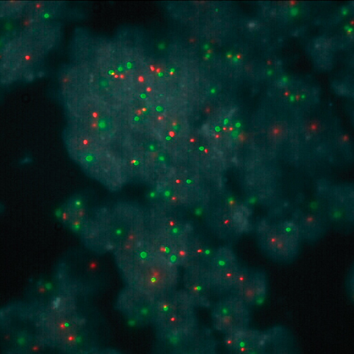 TOP2A (17q21) / SE 17 product photo