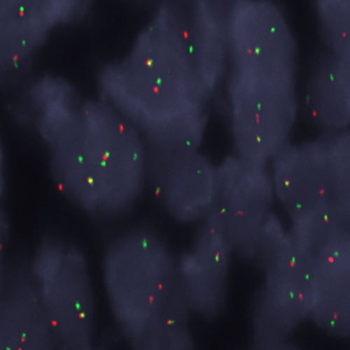 EWSR1 (22q12) Break – XL for BOND product photo