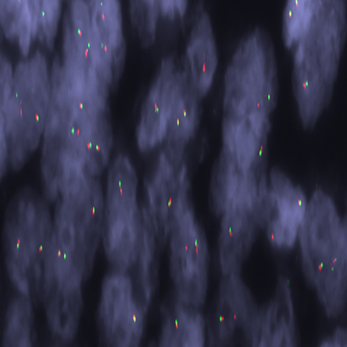FUS (16p11) Break - XL for BOND product photo
