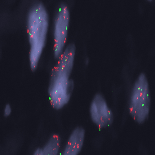 MDM2 (12q15) / SE12 (D12Z3)- XL for BOND product photo