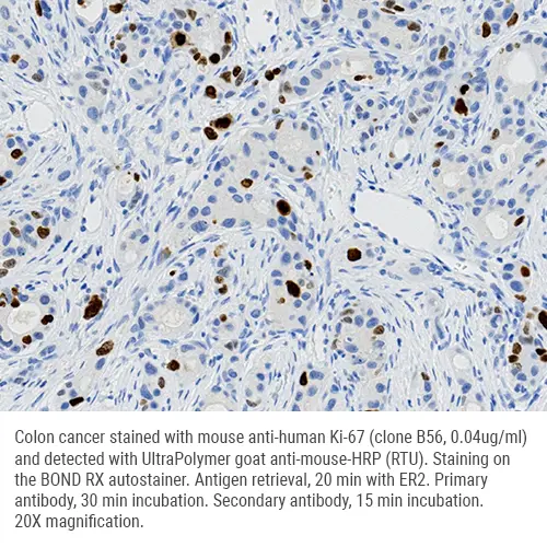 Anti-Mouse IgG UltraPolymer HRP 50mL product photo