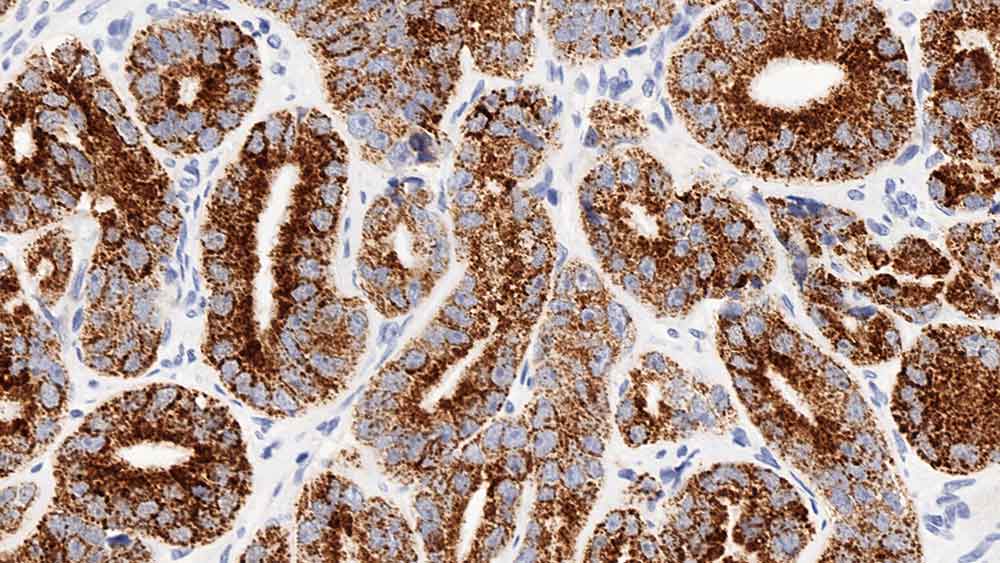 Alpha-Methylacyl-CoA Racemase (AMACR, p504s) 产品照片 Front View S