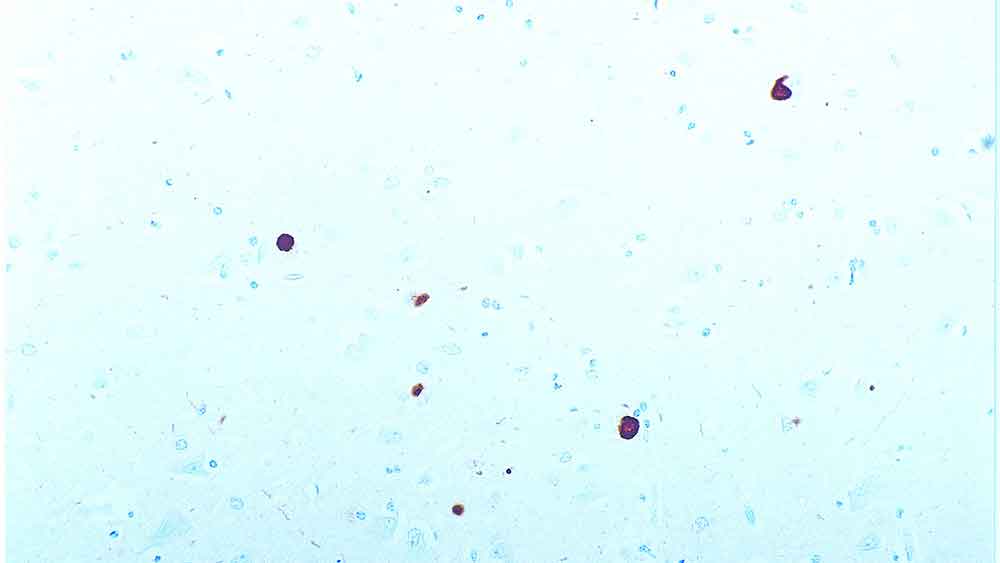 Alpha-Synuclein 产品照片 Front View S