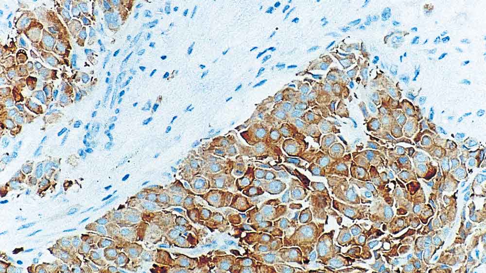 Synaptophysin 产品照片 Front View S